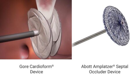 Forms of structural heart disease