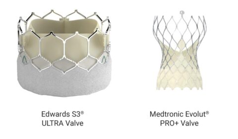 Transcatheter aortic valve replacement procedures