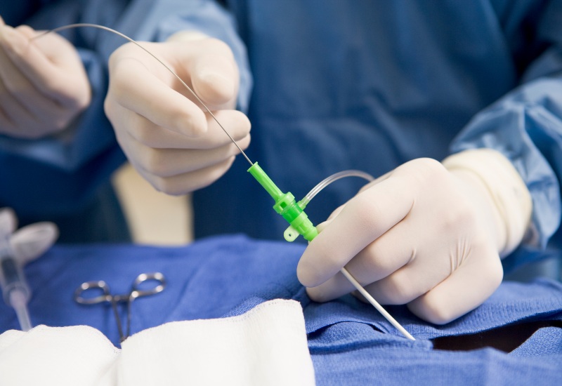 Cardiac Catherization in Peoria, AZ
